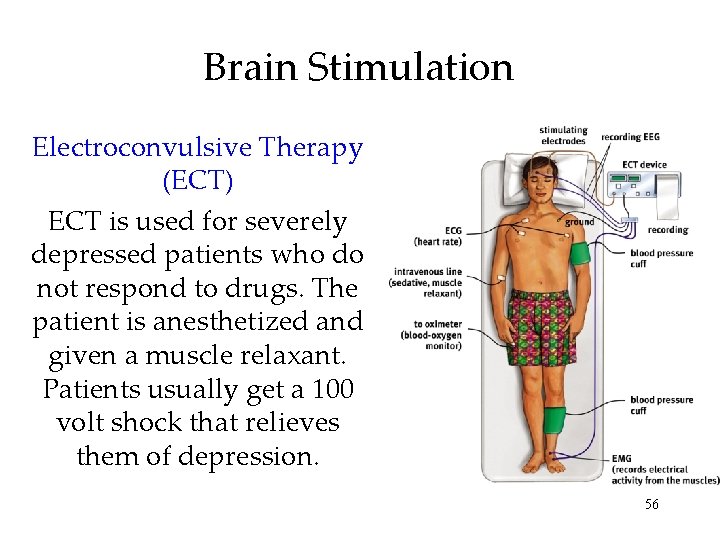 Brain Stimulation Electroconvulsive Therapy (ECT) ECT is used for severely depressed patients who do