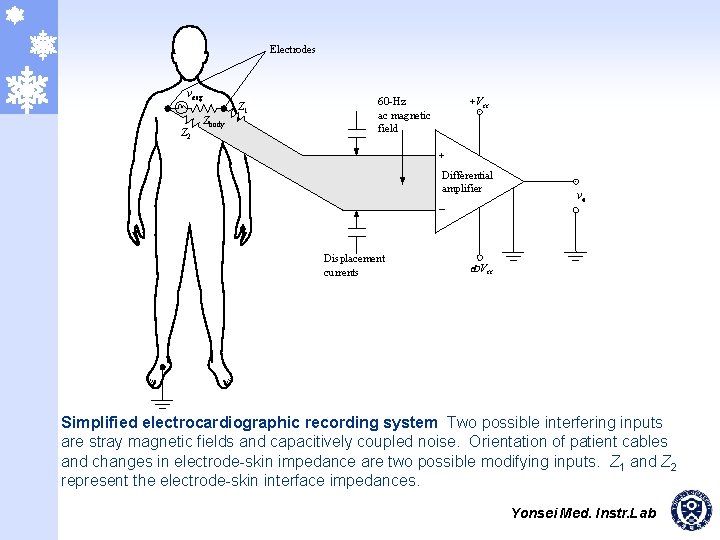 Electrodes vecg Z 2 Zbody Z 1 +Vcc 60 -Hz ac magnetic field +