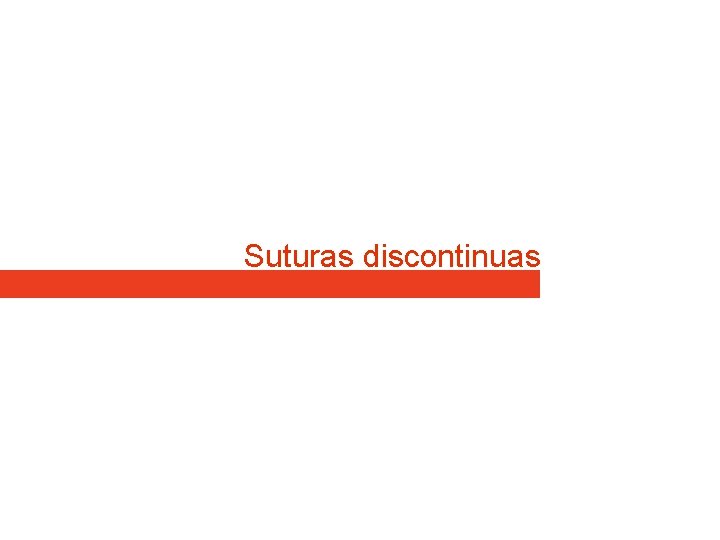 Suturas discontinuas Suturas discontinuas