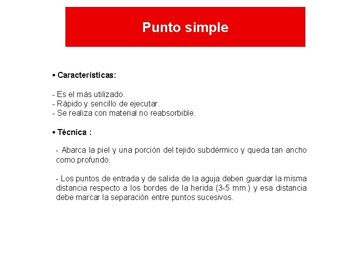 Punto simple • Características: - Es el más utilizado. - Rápido y sencillo de Punto simple • Características: - Es el más utilizado. - Rápido y sencillo de