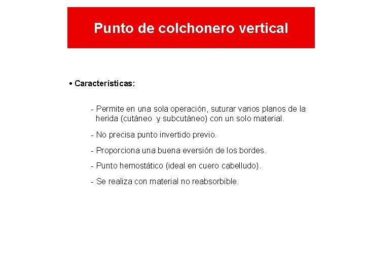 Punto de colchonero vertical • Características: - Permite en una sola operación, suturar varios Punto de colchonero vertical • Características: - Permite en una sola operación, suturar varios