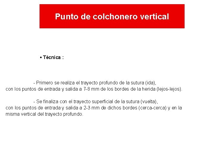 Punto de colchonero vertical • Técnica : - Primero se realiza el trayecto profundo Punto de colchonero vertical • Técnica : - Primero se realiza el trayecto profundo