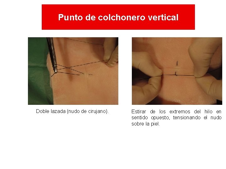 Punto de colchonero vertical Doble lazada (nudo de cirujano). Estirar de los extremos del Punto de colchonero vertical Doble lazada (nudo de cirujano). Estirar de los extremos del