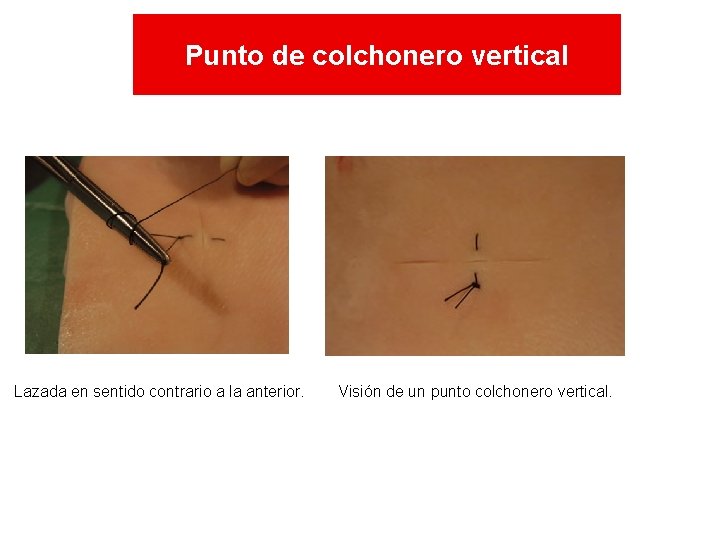 Punto de colchonero vertical Lazada en sentido contrario a la anterior. Visión de un Punto de colchonero vertical Lazada en sentido contrario a la anterior. Visión de un