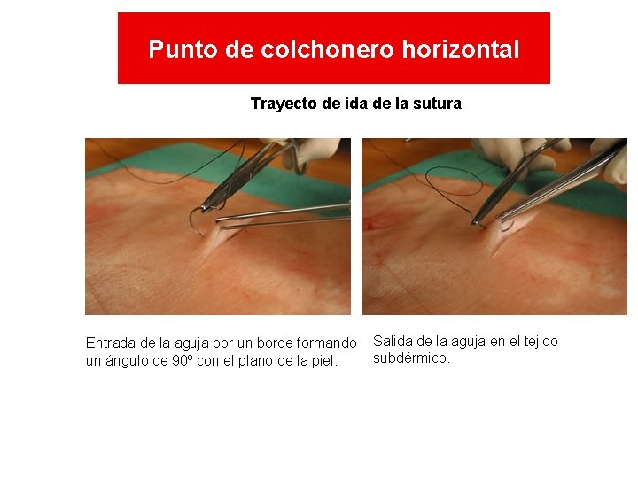 Punto de colchonero horizontal Trayecto de ida de la sutura Entrada de la aguja Punto de colchonero horizontal Trayecto de ida de la sutura Entrada de la aguja
