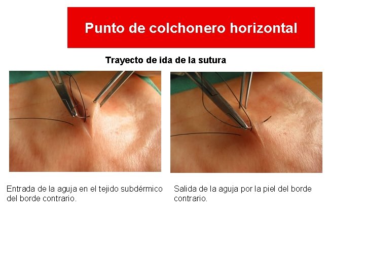 Punto de colchonero horizontal Trayecto de ida de la sutura Entrada de la aguja Punto de colchonero horizontal Trayecto de ida de la sutura Entrada de la aguja
