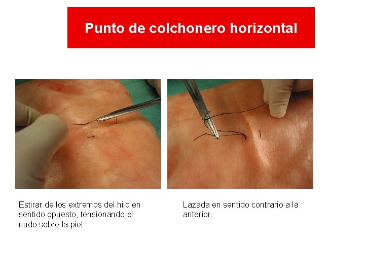 Punto de colchonero horizontal Estirar de los extremos del hilo en sentido opuesto, tensionando Punto de colchonero horizontal Estirar de los extremos del hilo en sentido opuesto, tensionando