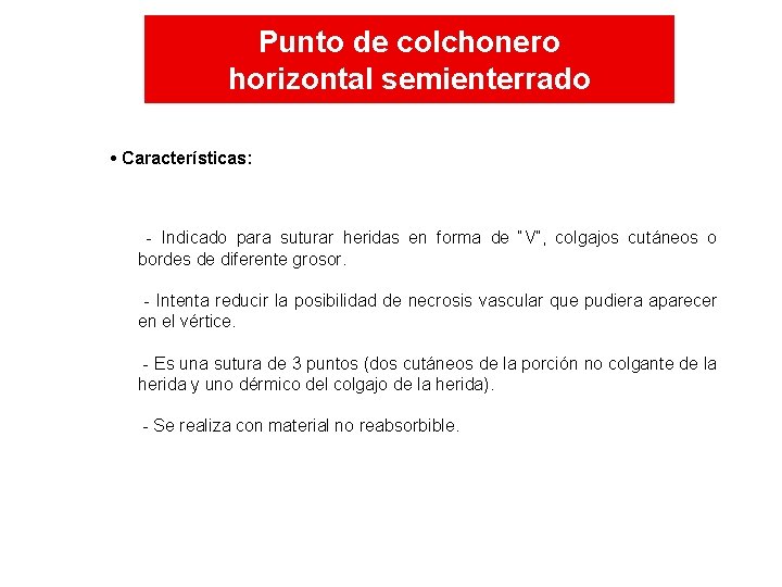 Punto de colchonero horizontal semienterrado • Características: - Indicado para suturar heridas en forma Punto de colchonero horizontal semienterrado • Características: - Indicado para suturar heridas en forma