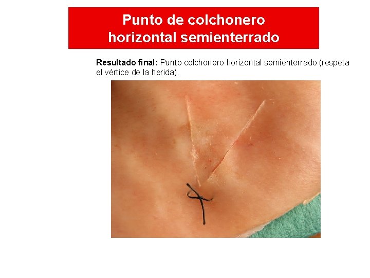 Punto de colchonero horizontal semienterrado Resultado final: Punto colchonero horizontal semienterrado (respeta el vértice Punto de colchonero horizontal semienterrado Resultado final: Punto colchonero horizontal semienterrado (respeta el vértice