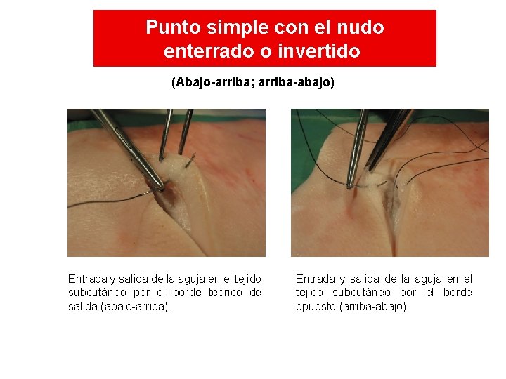 Punto simple con el nudo enterrado o invertido (Abajo-arriba; arriba-abajo) Entrada y salida de Punto simple con el nudo enterrado o invertido (Abajo-arriba; arriba-abajo) Entrada y salida de