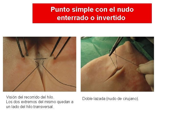Punto simple con el nudo enterrado o invertido Visión del recorrido del hilo. Los Punto simple con el nudo enterrado o invertido Visión del recorrido del hilo. Los