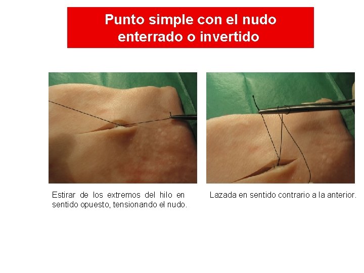 Punto simple con el nudo enterrado o invertido Estirar de los extremos del hilo Punto simple con el nudo enterrado o invertido Estirar de los extremos del hilo