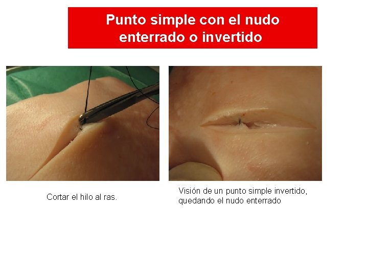 Punto simple con el nudo enterrado o invertido Cortar el hilo al ras. Visión Punto simple con el nudo enterrado o invertido Cortar el hilo al ras. Visión