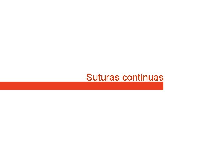 Suturas continuas Suturas continuas