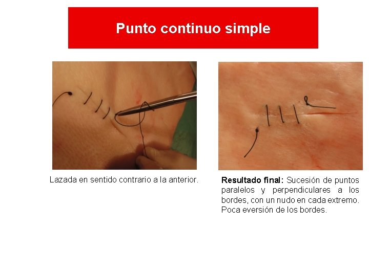 Punto continuo simple Lazada en sentido contrario a la anterior. Resultado final: Sucesión de Punto continuo simple Lazada en sentido contrario a la anterior. Resultado final: Sucesión de