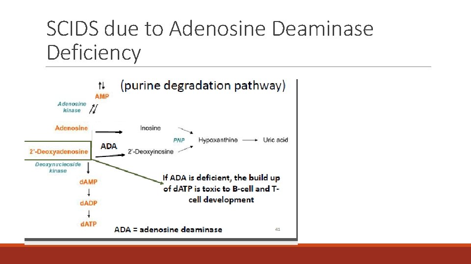 SCIDS due to Adenosine Deaminase Deficiency SCIDS due to Adenosine Deaminase Deficiency