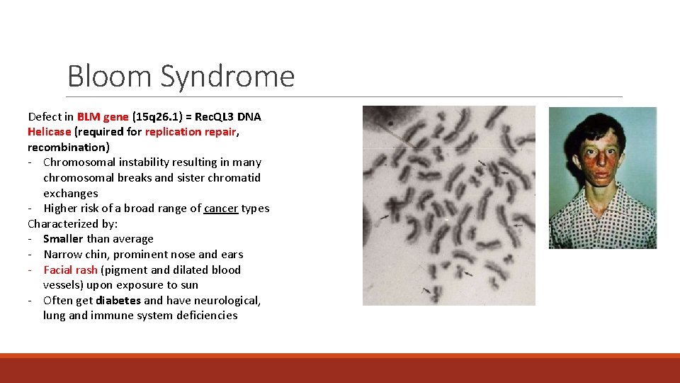Bloom Syndrome Defect in BLM gene (15 q 26. 1) = Rec. QL 3 Bloom Syndrome Defect in BLM gene (15 q 26. 1) = Rec. QL 3