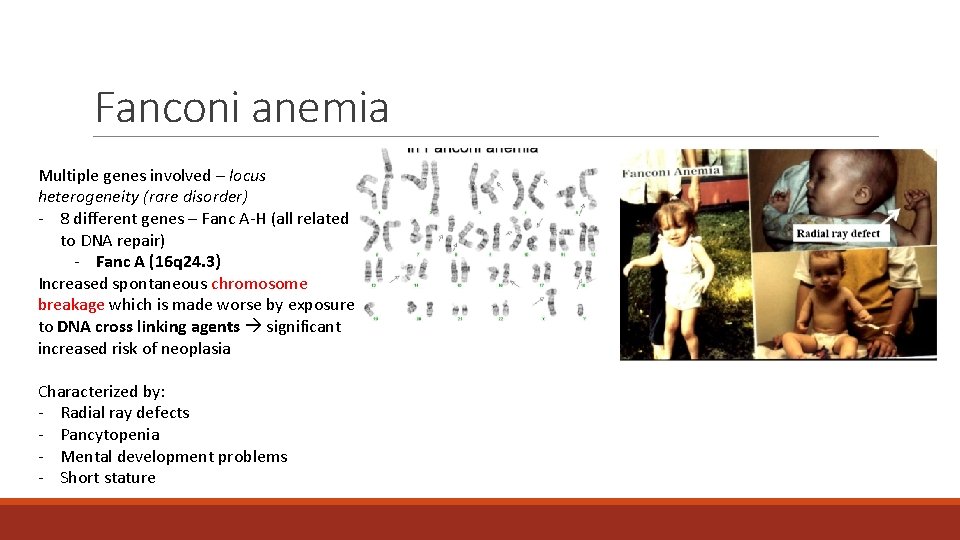 Fanconi anemia Multiple genes involved – locus heterogeneity (rare disorder) - 8 different genes Fanconi anemia Multiple genes involved – locus heterogeneity (rare disorder) - 8 different genes
