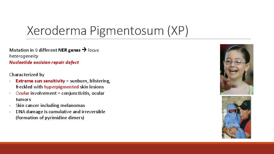 Xeroderma Pigmentosum (XP) Mutation in 9 different NER genes locus heterogeneity Nucleotide excision repair Xeroderma Pigmentosum (XP) Mutation in 9 different NER genes locus heterogeneity Nucleotide excision repair