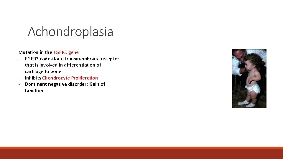 Achondroplasia Mutation in the FGFR 3 gene - FGFR 3 codes for a transmembrane Achondroplasia Mutation in the FGFR 3 gene - FGFR 3 codes for a transmembrane