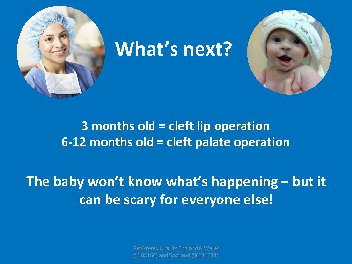 What’s next? 3 months old = cleft lip operation 6 -12 months old =