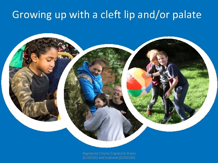 Growing up with a cleft lip and/or palate Registered Charity England & Wales (1108160)