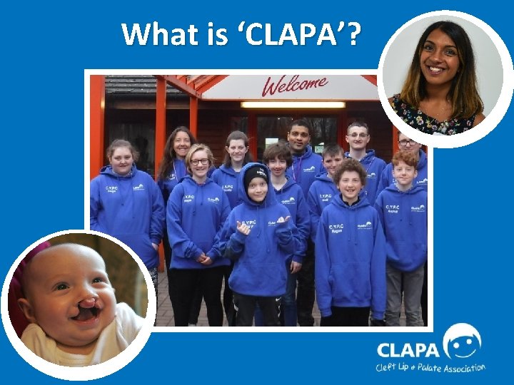 What is ‘CLAPA’? 