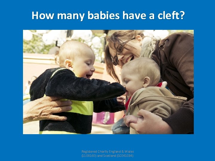 How many babies have a cleft? Registered Charity England & Wales (1108160) and Scotland