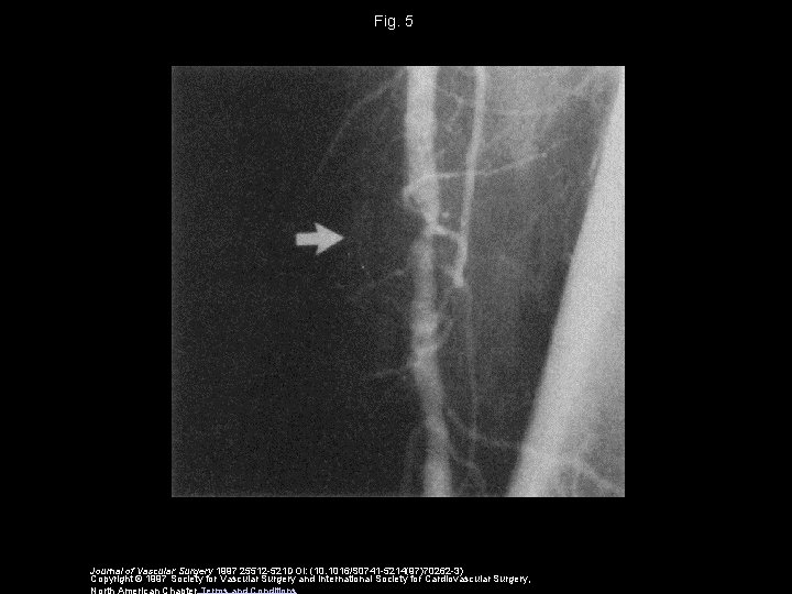 Fig. 5 Journal of Vascular Surgery 1997 25512 -521 DOI: (10. 1016/S 0741 -5214(97)70262