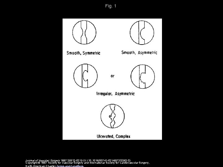 Fig. 1 Journal of Vascular Surgery 1997 25512 -521 DOI: (10. 1016/S 0741 -5214(97)70262