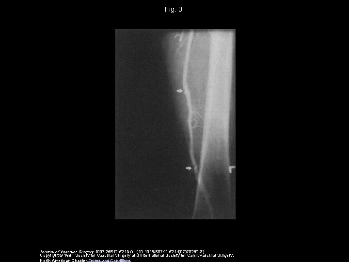 Fig. 3 Journal of Vascular Surgery 1997 25512 -521 DOI: (10. 1016/S 0741 -5214(97)70262