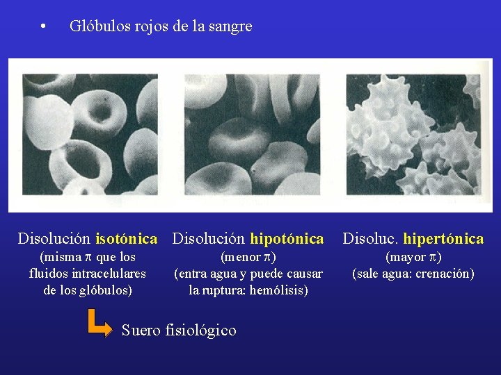  • Glóbulos rojos de la sangre Disolución isotónica Disolución hipotónica (misma p que