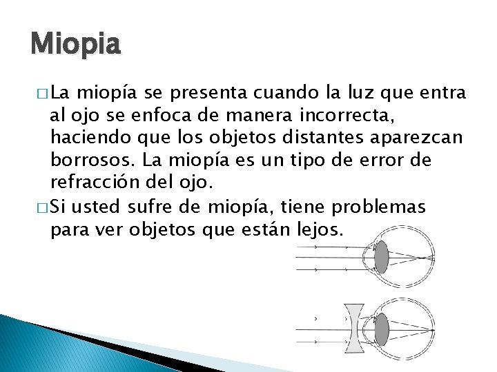 Miopia � La miopía se presenta cuando la luz que entra al ojo se
