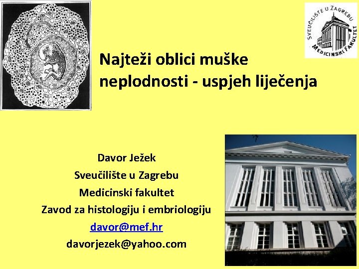 Najteži oblici muške neplodnosti - uspjeh liječenja Davor Ježek Sveučilište u Zagrebu Medicinski fakultet