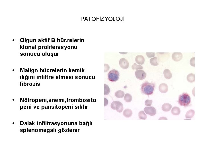 PATOFİZYOLOJİ • Olgun aktif B hücrelerin klonal proliferasyonu sonucu oluşur • Malign hücrelerin kemik