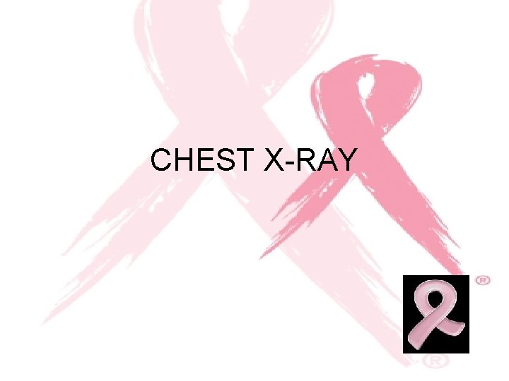 CHEST X-RAY 