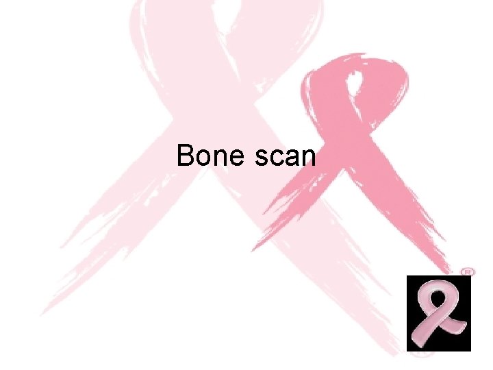 Bone scan 