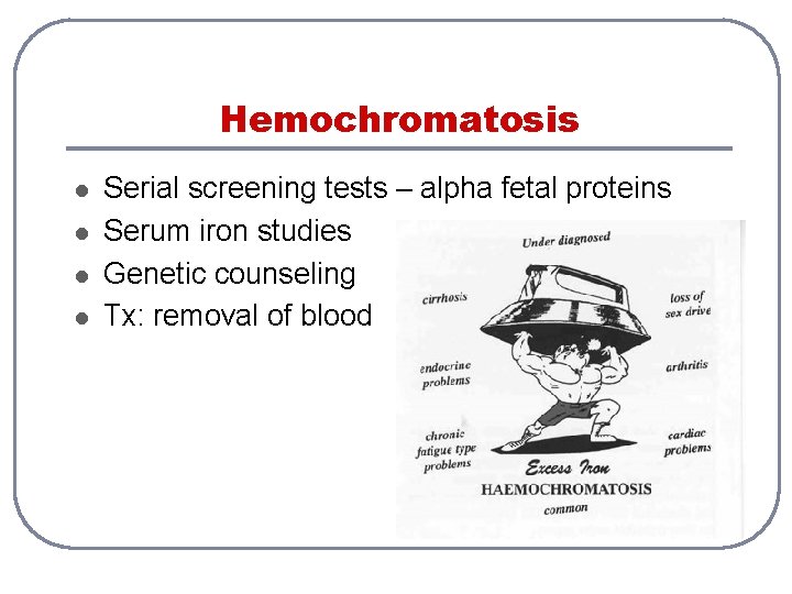 Hemochromatosis l l Serial screening tests – alpha fetal proteins Serum iron studies Genetic