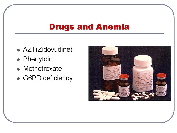 Drugs and Anemia l l AZT(Zidovudine) Phenytoin Methotrexate G 6 PD deficiency Drugs and Anemia l l AZT(Zidovudine) Phenytoin Methotrexate G 6 PD deficiency