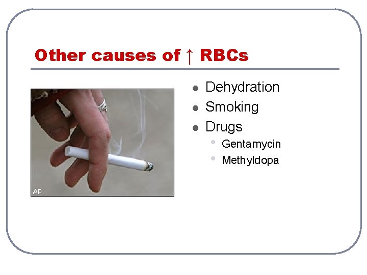 Other causes of ↑ RBCs l l l Dehydration Smoking Drugs • • Gentamycin