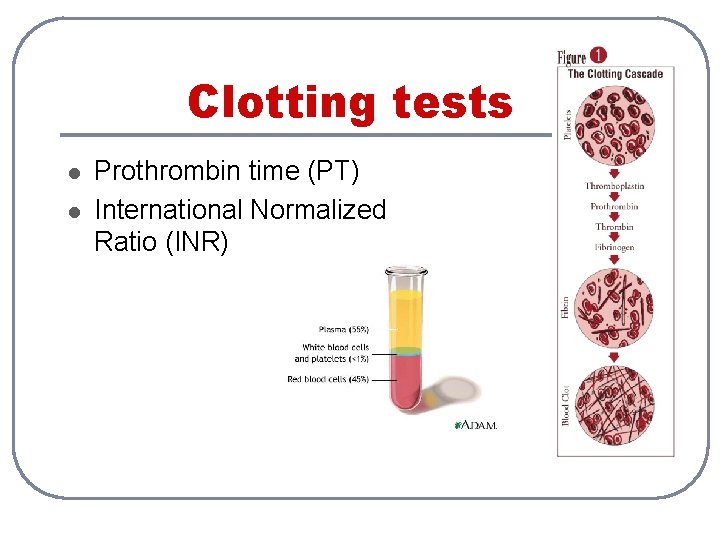 Clotting tests l l Prothrombin time (PT) International Normalized Ratio (INR) 