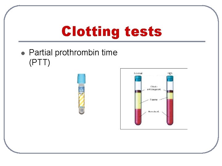 Clotting tests l Partial prothrombin time (PTT) 