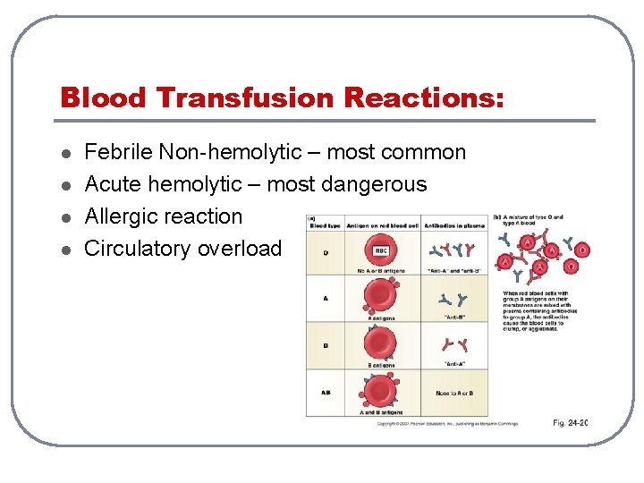 Blood Transfusion Reactions: l l Febrile Non-hemolytic – most common Acute hemolytic – most