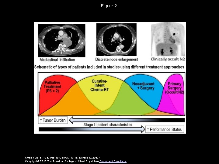 Figure 2 CHEST 2013 143 e 314 S-e 340 SDOI: (10. 1378/chest. 12 -2360)