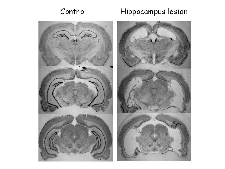 Control Hippocampus lesion 