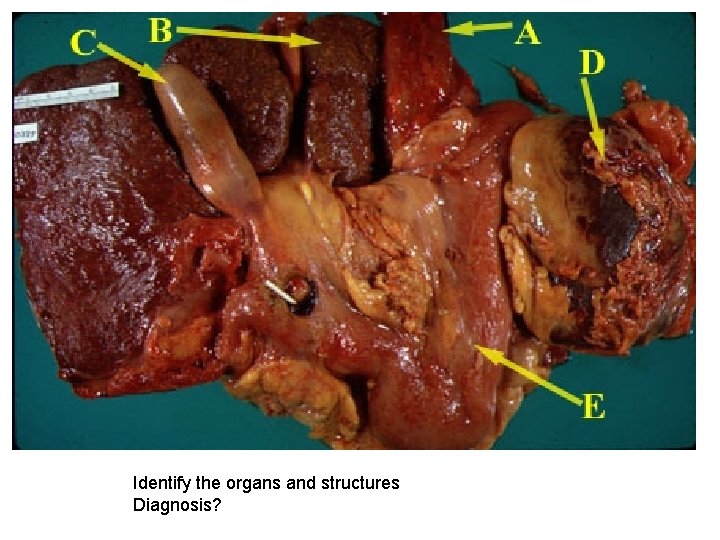 Identify the organs and structures Diagnosis? 