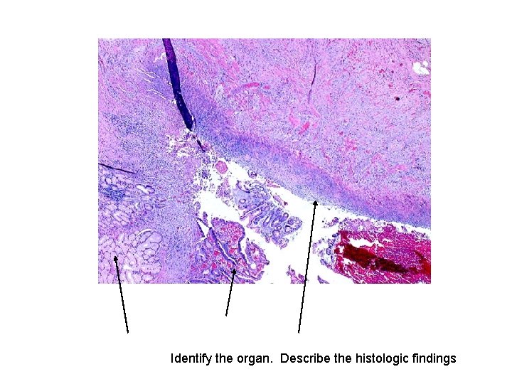 Identify the organ. Describe the histologic findings 