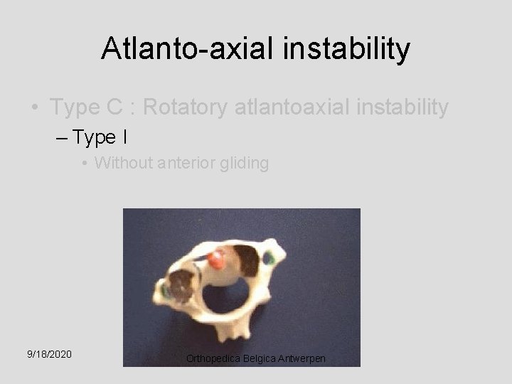 Atlanto-axial instability • Type C : Rotatory atlantoaxial instability – Type I • Without