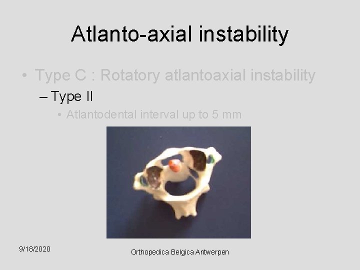 Atlanto-axial instability • Type C : Rotatory atlantoaxial instability – Type II • Atlantodental