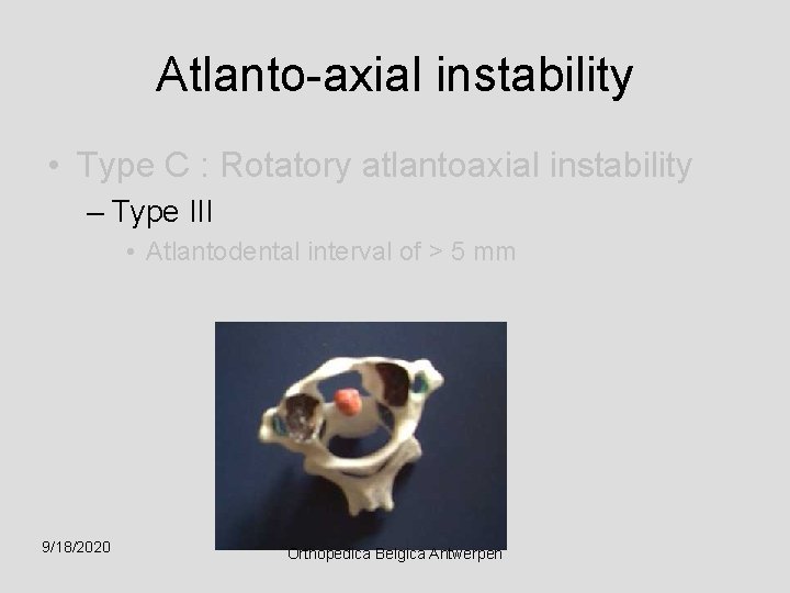 Atlanto-axial instability • Type C : Rotatory atlantoaxial instability – Type III • Atlantodental